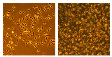 Human Epidermal Neonatal Melanocyte Medium