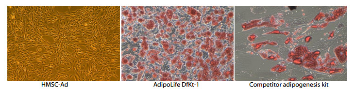 adipogenesis medium for differentiation to adipocytes