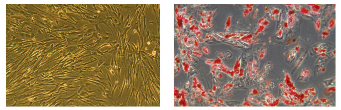 adipogenesis medium for Bone Marrow Stem Cells