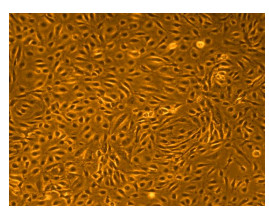 Human Microvascular Endothelial Cells Medium Testing