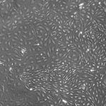 FC-0039, Adult Microvascular Endothelial Cells, 10x