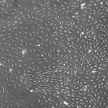 Human Endothelial Cells