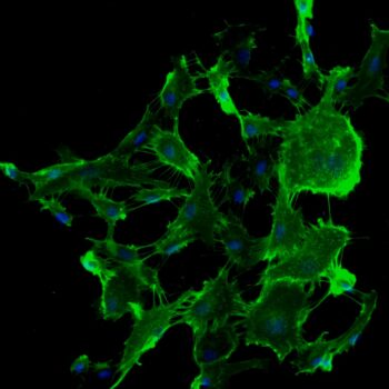 FC-0058 Lung Microvascular Endothelial Cells 20x
