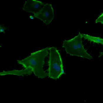 FC-0058 Lung Microvascular Endothelial Cells 40x