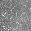 FC-0058, Lung Microvascular Endothelial Cells, 10x