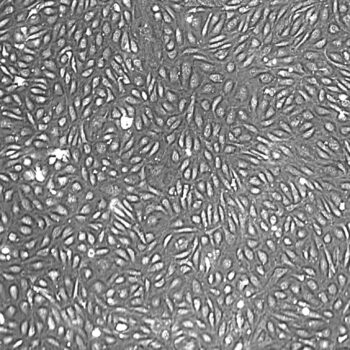 FC-0058, Lung Microvascular Endothelial Cells, 10x