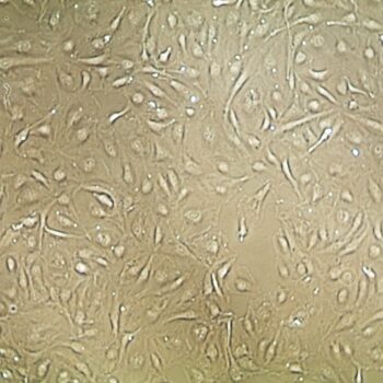 Cardiac Microvascular Endothelial Cells FC-0053