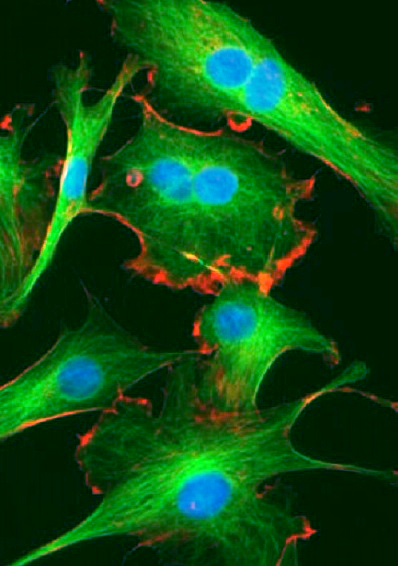 Lifeline® Dermal Fibroblasts used in wound healing study