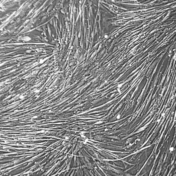 Skeletal Muscle Cells