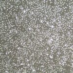 Human Cervical Epithelial Cells FC-0080