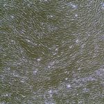 FC-0098 Human Scleral Fibroblasts, 10x