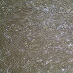 FC-0100, Prostate Smooth Muscle Cells, 10x