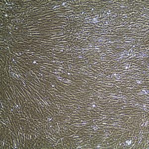 FC-0100, Prostate Smooth Muscle Cells, 10x
