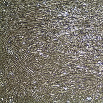 FC-0100, Prostate Smooth Muscle Cells, 10x