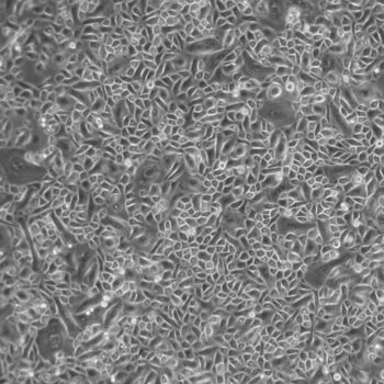 FC 0103 Bronchial Tracheal Epithelial Cells Diseased Cystic Fibrosis