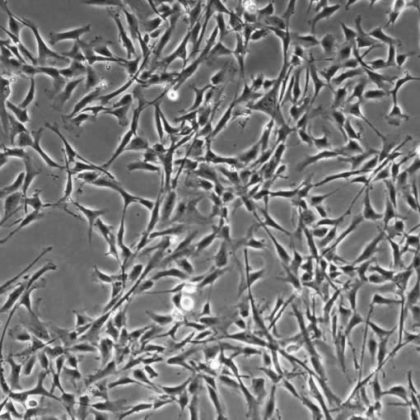 Smooth Muscle Cells