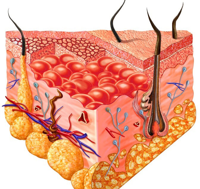 Lifeline® Keratinocytes in Chemotaxis Research