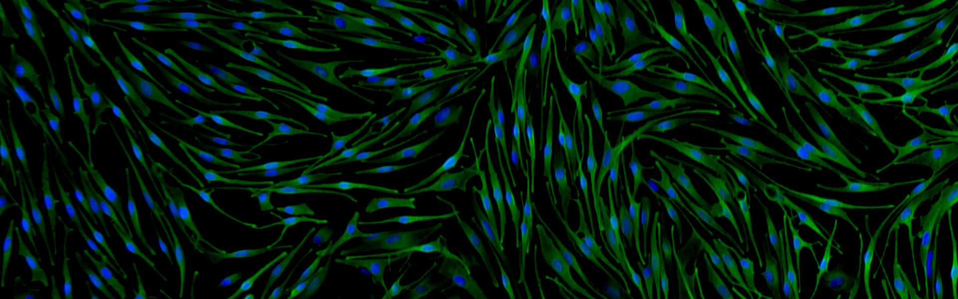 Human Neonatal Melanocytes