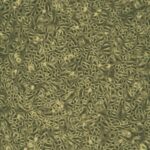 FC-0106 small airway cells, secondary