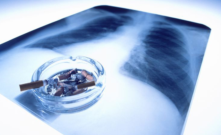 e cigarette recommendations Global Regulatory Approaches towards E-Cigarettes, Key Arguments, and  Approaches Pursued