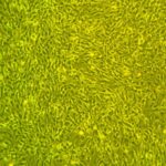 Cardiac Fibroblasts FC-0060 Day 7