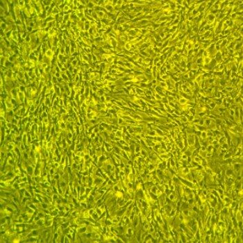 Cardiac Fibroblasts FC-0060 Day 7