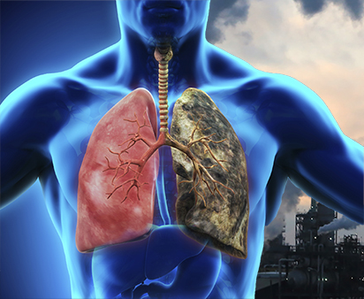 The Impact of Air Pollution on Lung Health